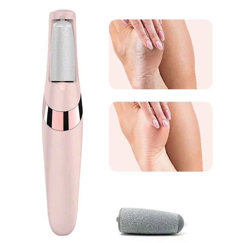 Electric Foot File – Callus Remover
